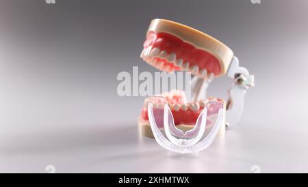 educational model of human jaw with teeth and implants Stock Photo - Alamy
