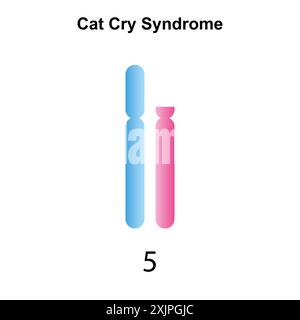 Cat cry syndrome, illustration. Stock Photo