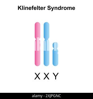 Klinefelter syndrome, illustration. Stock Photo