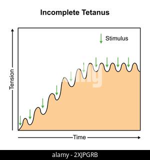 Incomplete tetanus muscle contraction, illustration. Stock Photo