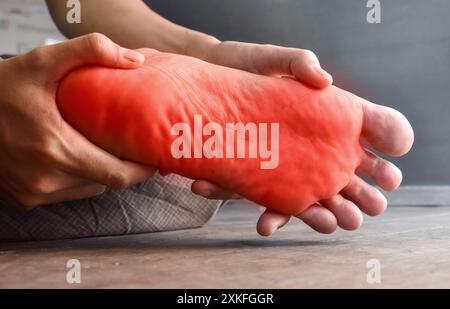 Tingling and burning sensation in foot of Asian young man with diabetes. Foot pain. Sensory neuropathy problems. Foot nerves problems. Plantar fasciit Stock Photo