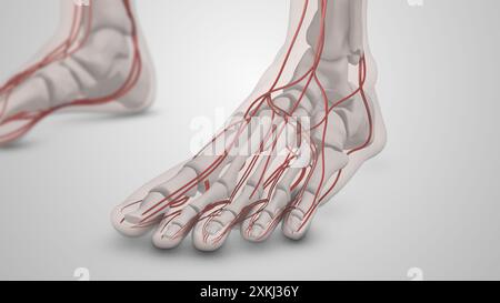 Diabetic blood vessel damage in the feet Stock Photo