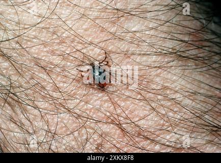 TICK - on human flesh Stock Photo