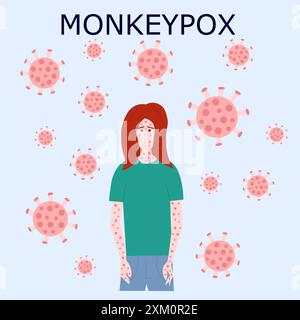 Monkey pox virus infographics with transmission ways from human and ...