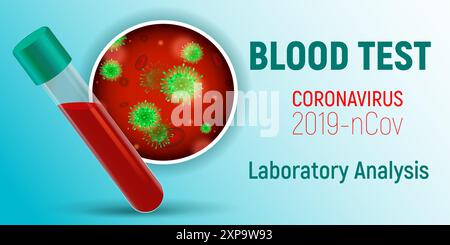 Coronavirus 2019-nCov. Laboratory analysis. Asian flu outbreak and coronaviruses influenza pandemic. View under a microscope. Blood test composition w Stock Vector
