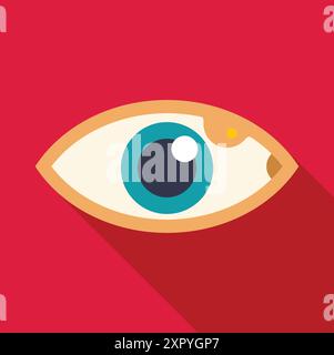 Human eye with yellow discoloration, a sign of jaundice, depicted in a medical illustration Stock Vector