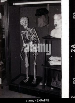 Joseph 'John' Carey Merrick (1862-90) - aka The Elephant Man. Pathology collection of  Royal London Hospital in Whitechapel c.1980s Stock Photo