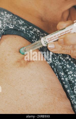 Close-up of woman arm with insulin pen. Mature lady injecting diabetes treatment with syringe. Concept of diabetic people taking care. Health and age Stock Photo