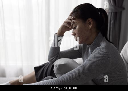Suffer from depression , mental health problem. asian young woman sitting on the sofa feeling depressed. Women are stressed and depressed. Stock Photo