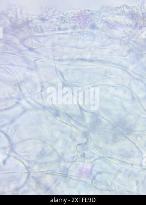 wallemia-mellicola-fungi-stock-photo-alamy