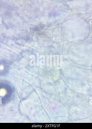wallemia-mellicola-fungi-stock-photo-alamy