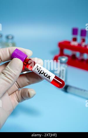 Blood collection tubes monkeypox （MPOX） test positive results Stock ...