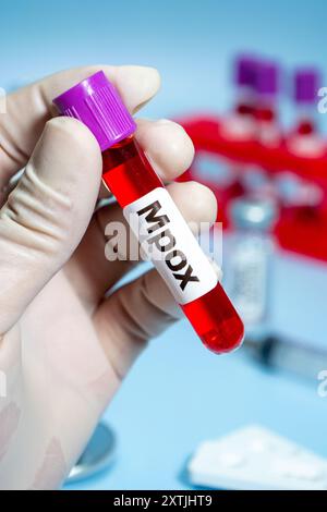 Mpox monkeypox virus, laboratory and blood test tube Stock Photo - Alamy