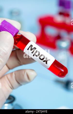 Blood collection tubes monkeypox （MPOX） test positive results Stock ...