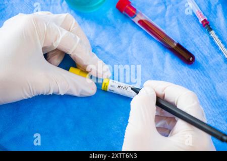 Mpox monkeypox virus, laboratory and blood test tube Stock Photo - Alamy