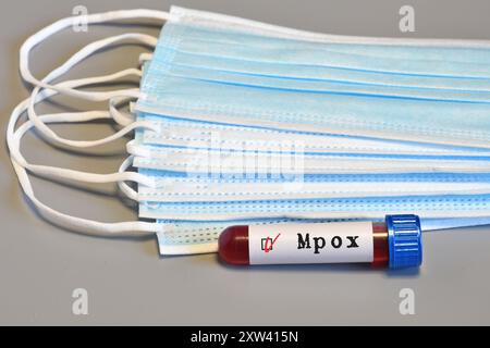 Blood collection tubes monkeypox test positive results Stock Photo - Alamy