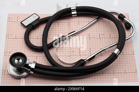 Stethoscope on electrocardiogram in paper form. Heart disease prevention. Stock Photo