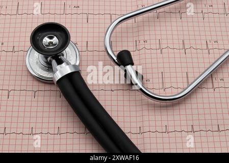 Stethoscope on electrocardiogram in paper form. Heart disease treatment and prevention. Stock Photo