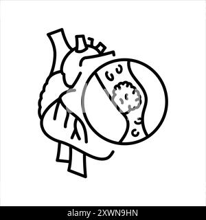 Thrombosis of the heart line black icon. Sign for web page, mobile app, button, logo. Vector isolated button. Editable stroke. Stock Vector