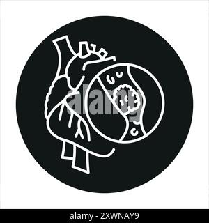 Thrombosis of the heart line black icon. Sign for web page, mobile app, button, logo. Vector isolated button. Editable stroke. Stock Vector