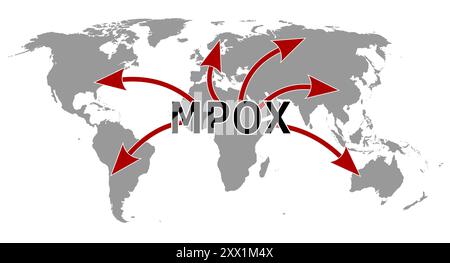 Vector illustration of MPOX diseases spreading from Africa to whole world Stock Photo