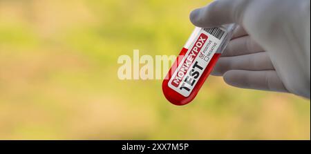 Mpox monkeypox virus blood test. Doctor in white gloves in holding a blood sample for the Orthopoxvirus Mpox virus. Selective focus of a labeled glass Stock Photo