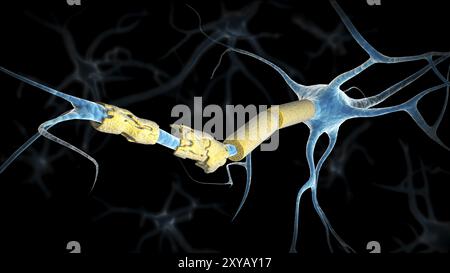 Conceptual image of a multiple sclerosis neuron Stock Photo