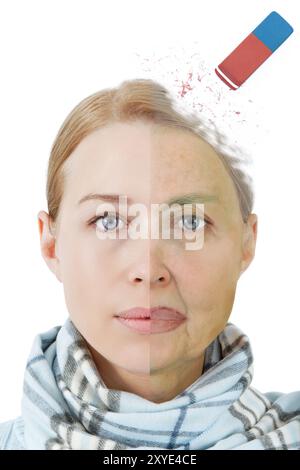 Alzheimer's disease Stock Photo