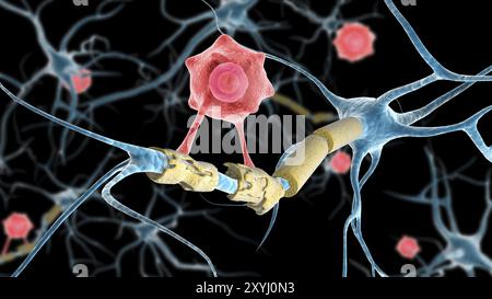 Conceptual image of a multiple sclerosis neuron healed by a T-cell Stock Photo