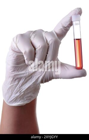 Hand holding a blood sample for analysis, isolated Stock Photo