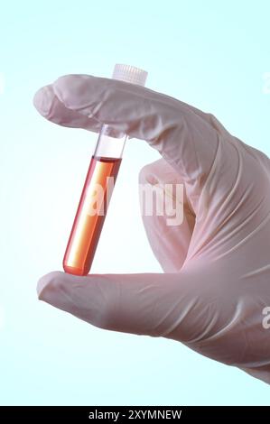 Hand holding a blood sample for analysis Stock Photo