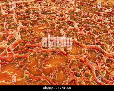 Close-up view of athlete's foot fungus, also known as ringworm of the foot and tinea pedis. Athlete's foot fungus is a fungal infection of the skin Stock Photo