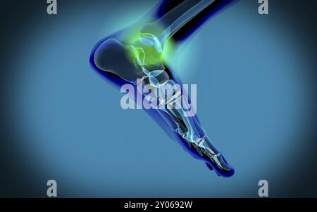 X-ray view of pain in human foot Stock Photo