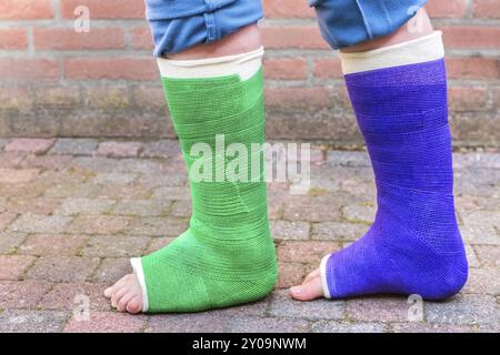 Standing teenage boy with two colorful gypsum legs outdoors Stock Photo