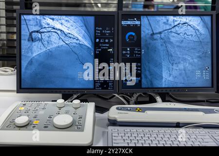 Istanbul, Turkey 28 February 2024; Angiogram sequence working clockwise using x-rays with a contrast agent injected from a tube inserted into the arte Stock Photo