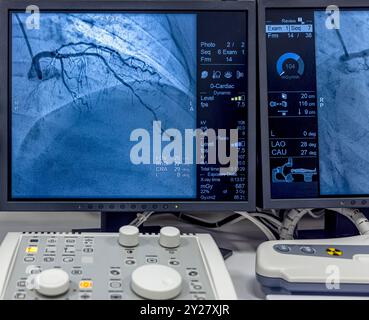 Istanbul, Turkey 28 February 2024; Angiogram sequence working clockwise using x-rays with a contrast agent injected from a tube inserted into the arte Stock Photo