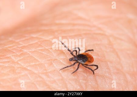 beetle on the human skin. parasite close-up Stock Photo - Alamy