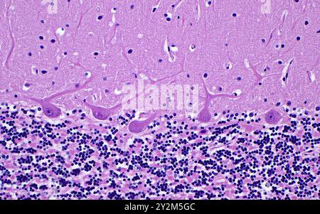 Light micrograph of cerebellum Purkinje neurons. The distinctive Purkinje neuron cell bodies (central image) are located between the granular cell layer (darker blue, bottom half of picture), and the molecular layer (top light pink half of picture). Dendrites (thin projections) branch out from the cell bodies into the molecular layer. Haematoxylin and eosin stained tissue section. Magnification: 200x when printed at 10 centimetres. Stock Photo