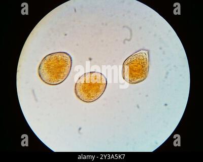 Asparagus rust (Puccinia asparagi) Fungi Stock Photo - Alamy