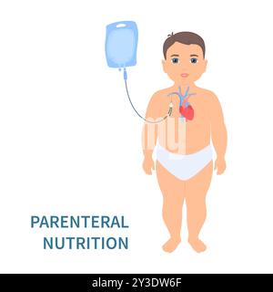 Child receiving parenteral nutrition through a central intravenous access Stock Vector