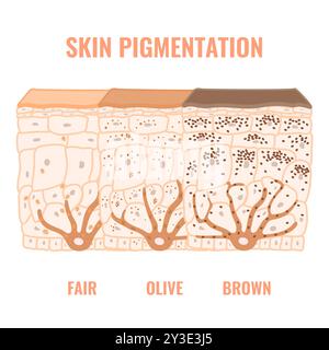 Human skin tone pigmentation diversity infographic diagram Stock Vector ...