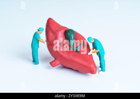 Two miniature surgeons conducting a procedure on a huge vibrant liver model, illustrating medical practice and anatomy. Stock Photo