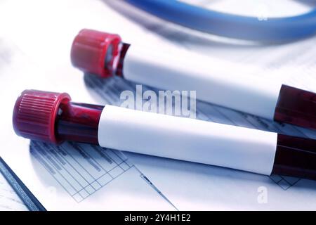 Blood in test tubes with blank labels on medical forms, closeup. Laboratory analysis Stock Photo