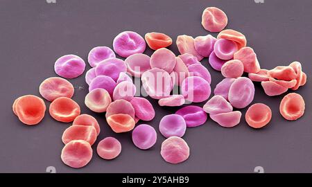 Red blood cells. Coloured scanning electron micrograph (SEM) of red blood cells (RBCs, erythrocytes). Red blood cells are biconcave, disc-shaped cells that transport oxygen from the lungs to body cells. They circulate in the blood and also remove carbon dioxide to the lungs for exhalation. Their red colour is due to the oxygen-carrying protein haemoglobin. Red blood cells, the most abundant cell in the blood, have no nucleus and are about 7 micrometres across. Magnification: x 1000 when printed at 10 centimetres across. Stock Photo