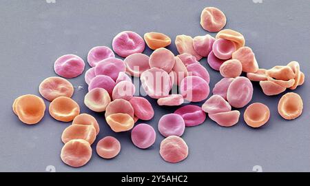 Red blood cells. Coloured scanning electron micrograph (SEM) of red blood cells (RBCs, erythrocytes). Red blood cells are biconcave, disc-shaped cells that transport oxygen from the lungs to body cells. They circulate in the blood and also remove carbon dioxide to the lungs for exhalation. Their red colour is due to the oxygen-carrying protein haemoglobin. Red blood cells, the most abundant cell in the blood, have no nucleus and are about 7 micrometres across. Magnification: x 1000 when printed at 10 centimetres across. Stock Photo