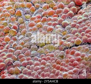 Fat cells. Coloured scanning electron micrograph (SEM) of joined fat-storing cells (adipocytes). Fat cells are one of the largest cell types in the human body, each cell being 100 to 120 microns in diameter. Almost the entire volume of an individual fat cell consists of a single lipid (fat or oil) droplet. Fat cells and their supporting connective tissue (surrounding the fat cells), make up fat tissue. Fat tissue forms an insulating layer under the skin, storing energy in the form of fat created from excess food. Magnification when printed at 10cm wide: x 60 Stock Photo