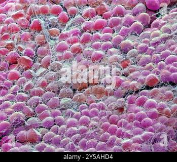 Fat cells. Coloured scanning electron micrograph (SEM) of joined fat-storing cells (adipocytes). Fat cells are one of the largest cell types in the human body, each cell being 100 to 120 microns in diameter. Almost the entire volume of an individual fat cell consists of a single lipid (fat or oil) droplet. Fat cells and their supporting connective tissue (surrounding the fat cells), make up fat tissue. Fat tissue forms an insulating layer under the skin, storing energy in the form of fat created from excess food. Magnification when printed at 10cm wide: x 60 Stock Photo