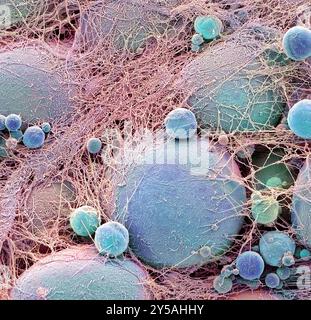 Fat cells. Coloured scanning electron micrograph (SEM) of joined fat-storing cells (adipocytes). Fat cells are one of the largest cell types in the human body, each cell being 100 to 120 microns in diameter. Almost the entire volume of an individual fat cell consists of a single lipid (fat or oil) droplet. Fat cells and their supporting connective tissue (surrounding the fat cells), make up fat tissue. Fat tissue forms an insulating layer under the skin, storing energy in the form of fat created from excess food. Magnification when printed at 10cm wide: x 350 Stock Photo