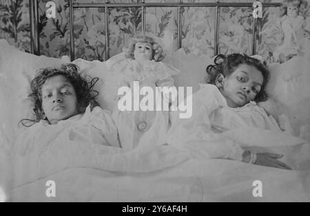 Radica & Doodica, Joint Hindoo twins after operation, Photo shows conjoined twins Radica and Doodica who were separated by Dr. Eugene-Louis Doyen in 1902., 1902, Glass negatives, 1 negative: glass; 5 x 7 in. or smaller. Stock Photo