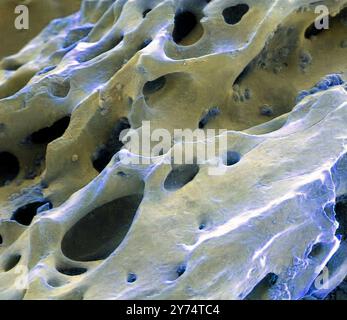 Fossilised dinosaur bone, coloured scanning electron micrograph (SEM). This specimen is from a Tyrannosaurus rex fossil. This dinosaur was a carnivore from the Cretaceous Period. The circular holes are the Haversian canals that carry blood vessels. Magnification: x20 when printed at 10 centimetres across. Stock Photo